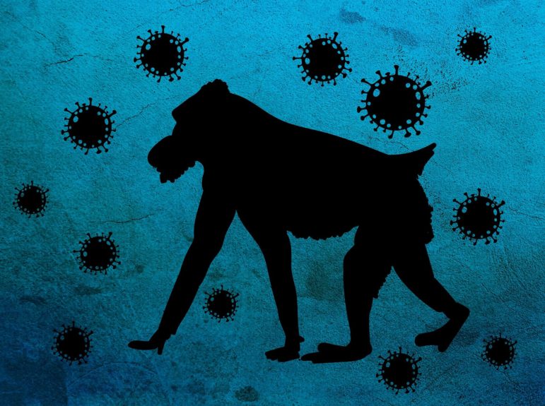 monkey pox 7226817 1920